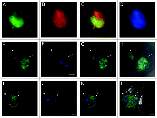 Figure 8. Distribution of H4K12ac in human sperm nucleus and during mouse early embryo development. Co-localization of H4K12ac (A) and protamine-1 (B) visualized by immunofluorescence using FITC (green) and Cy3 (red) conjugated antibodies (merge) (C). DAPI was used for DNA staining (blue) (D). Immunolabeling of H4K12ac was detected in the post-acrosomal region of the sperm head, while red staining of protamine-1 was spread over the whole nucleus. Immunofluorescent labeling of H4K12ac in early stages of pronuclei establishment (E–H); Pronuclei fusion (I–L); H4K12ac staining (green). Male pronucleus, shown by arrow, gives strong positive signal compares to a smaller female pronucleus shown by asterisk; DNA stained by DAPI (blue) (B,F,); H4K12ac and DAPI (C,G); H4K12ac, DAPI and DIC (D,H). Scale bars represent 10 µm. Photos are merged for each displayed color labeling from several sequenced slices taken by a Leica confocal microscope.