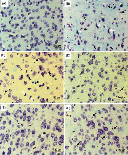 Figure 7. Luxol fast blue-cresyl violet – coronal section; brain (40X): (A) substantia nigra (SN) of control mice showing normal histology. (B) and (C) SN of MPTP alone-administered mice showing loss of neurons along with nuclear pyknosis (white arrow) and increase in the number of spindle-shaped microglial cells (black arrow) indicating inflammatory response. (D–F) Coronol sections of ferulic acid (FA) supplemented MPTP-intoxicated mice at different doses 20 mg, 40 mg, and 80 mg/b.w., respectively, showing decreased microglial cells and increased intact neuronal cells.