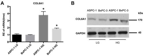 Figure 4 Expressions of Col6a1 gene and COL6A1 protein in PC cancer cells under different extracellular glucose levels. (A) Expressions of Col6a1 gene; (B) Expressions of COL6A1 protein. *P < 0.05.