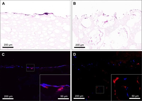 Figure 11 (A and B) H&E staining and (C and D) immunofluorescence staining images for the cross-sections of (A and C) PLLA/PCL and (B and D) PLLA/PLGA/PCL scaffolds seeded with HVSMCs for 7 days.Notes: Red indicates α-SMA. Blue indicates cell nucleus.Abbreviations: HVSMCs, human vascular smooth muscle cells; PCL, poly(ε-caprolactone); PLGA, poly(lactic-co-glycolic acid); PLLA, poly(l-lactic acid); α-SMA, α-smooth muscle actin.