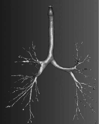 FIG. 1 Extracted image of lung airways. This image is from a 27-year-old, healthy, nonsmoking female (height = 154 cm, weight = 59.3 kg). This subject was responsive to the methacholine challenge—with the greatest change in airway patency seen in airway generations 4, 5, and 6.
