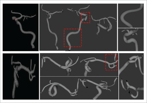 Figure 4. Vessel tree visualization. The left is vascular maps from Aneurisk, the middle presents the generated vascular trees with the proposed method from 3 different angles, and the right displays the amplified segments for observation purpose.