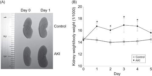 Figure 3. (A) Macroscopic findings of the AKI mouse kidney. Photograph showing the swollen kidneys of AKI mice on day 1 after 0.75% adenine ingestion. (B) Change of the ratio of kidney weight to body weight in AKI mice. The ratio of kidney weight to body weight in AKI mice increased after 0.75% adenine ingestion (n = 6 at each time point). Notes: Values are expressed as the mean ± SE. *p < 0.05.