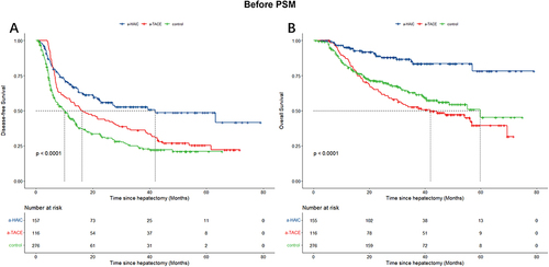 Figure 2 The Kaplan-Meier survival analysis of HCC patients DFS (A) and OS (B) before PSM between a-HAIC, a-TACE and control group.