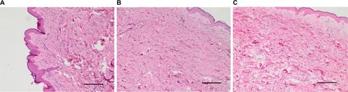 Figure 1 A histological examination of the skin biopsy specimens, stained with H&E (magnification ×100).