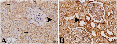 Figure 3. (A) Control group. (B) Study group: arrow head, intense positive cells; arrow, slightly positive cells, anti-caspase-3 (immunoperoxidase staining, 40×).