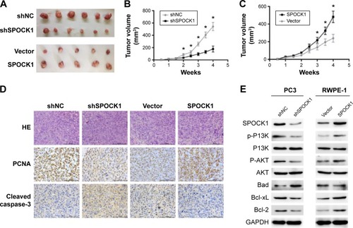 Figure 5 SPOCK1 affected tumor growth in a mouse model.
