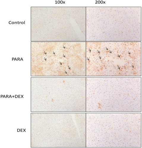 Figure 5 Effects of DEX on immunohistochemical evidence of macrophage accumulation following PARA-induced liver toxicity. Mice were administered saline (control), PARA (300 mg/kg) alone, DEX (25 μg/kg) 30 mins after PARA injection, or DEX (25 μg/kg) alone, and were sacrificed 16 hrs later for immunohistochemical staining. Liver sections were immunostained for macrophages (black; arrow). Typical images were chosen from each group.