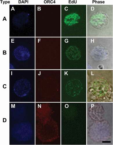 Figure 4. Only Type A cells have measureable levels of DNA replication. MEL cells were treated with Vacuolin-1 for 48 hrs, then incubated with EdU for 30 min and fixed for immunocytochemistry. Cells were stained for DAPI (blue, A, E, I, M) and ORC4 (note in this panel ORC4 staining is red, B, F, J, N), and EdU (green, C, G, K, O). Merged fluorescent and phase (D, H, L, P) images are shown. Cells were then scored for (A-D) Type A cells which had no ORC4 staining; (E-H) Type B (cells that had a small amount of ORC4 staining surrounding the nuclei of the cells; (I-L) Type C cells which had more intense staining of ORC4 around slightly condensed nuclei; and (M-P) Type D cells which were enucleating MEL cells which had more intense ORC4 staining throughout both the pyrenocyte and reticulocyte. Three experiments were performed analyzing a total of 732 cells with at least 236 cells in each category Bar = 5 µm