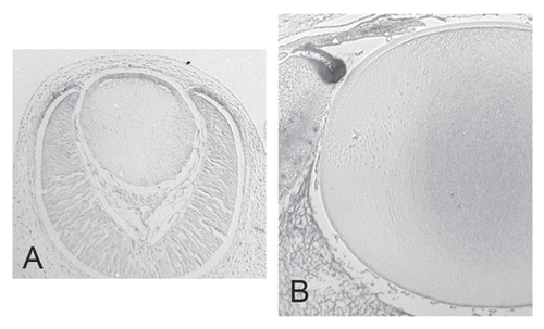 Figure 4 Restricted activation of canonical Wnt/β-catenin pathway during lens development. Mouse TCF/lef reporter gene assay shows transient strong Wnt/β-catenin pathway activity in most anterior lens epithelial cells around E13.5 (A). Reporter activity is absent from lens fibers at E13.5 (A) and P3 (B). In contrast, the reporter gene activity first detected in the peripheral region of the optic cup (A) extends through embryonic development and remains prominent in this region postnatally, particularly where the ciliary body differentiates (B).