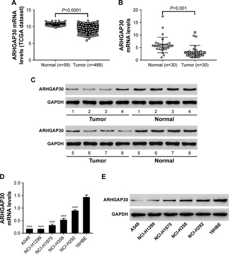 Figure 1 ARHGAP30 is markedly downregulated in lung cancer tissues and cell lines.***P<0.001.