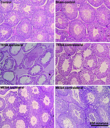Figure 2.  Photomicrograph of testis stained with hematoxylin and eosin taken from various experimental groups. Photomicrograph from control and sham-control rat testes demonstrating normal pattern of spermatogenesis. Histological picture from both ipsi and contralateral testes indicates alteration in TESA and MESA group. However, TESA group testis showing more damage especially ipsilateral testis was severely damaged and devoid of sperm cells in the majority of the tubules after TESA procedure. TESA: testicular sperm aspiration; MESA: microsurgical epididymal sperm aspiration