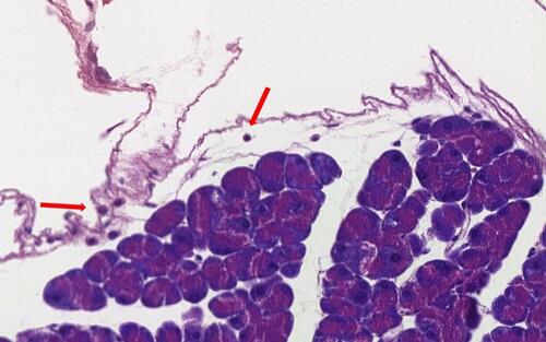 Figure 6 Sedentary ob/ob mouse pancreatic accino. Presence of rare lymphocytes (arrow) in loose periacinar tissue (original magnification ×40).