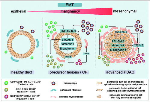 Figure 10. Simplified overview on the mutual epithelia-stroma-interaction promoting EMT and malignancy during inflammation-associated PDAC development. (A) Under physiological conditions, pancreatic ducts are embedded in a homeostatic stromal microenvironment comprising fibroblasts, T cells, and macrophages and exhibit an epithelial and polarized phenotype. (B) Upon chronic inflammation, predominantly CD4+ T effs and macrophages enrich in the pancreatic tissue leading to increased level of inflammatory mediators such as TNF-α and IL-6. This may either directly result from the infiltrated inflammatory cells or from an enhanced secretion by stromal and/or the epithelial cells upon their reciprocal interaction. As a result, elevated TNF-α and IL-6 levels promote EMT in pancreatic ducts leading to loss of E-cadherin expression, upregulation of mesenchymal proteins such as vimentin and L1CAM. This probably paves the way for an early dissemination of epithelial cells.Citation21,22 Elevated epithelial L1CAM expression, in turn, impairs the proliferation of CD4+ T-effs and promotes infiltration of CD4+CD25+CD127-CD49d- T-regs into the pancreas as well as the generation of immunosuppressive CD4+CD25-CD69+ T cells. These various subsets of regulatory T cells contribute to the manifestation of an immunosuppressive microenvironment, e.g., through TGF-β1. Besides its immunoregulatory function, TGF-β1 can directly induce EMT in epithelial/carcinoma cells but may also indirectly contribute to EMT by promoting transdifferentiation of pancreatic stellate cells into myofibroblasts and modulating the phenotype of macrophages. (C) Manifestation of these mechanisms shapes the stromal compartment of PDAC diminishing the percentage of CD4+ T-effs while increasing the percentages of T-reg subsets as well as myofibroblasts. The predominance of these stromal cell types results in a further elevation of TGF-β1 which augments an immunosuppressive microenvironment and EMT induction in carcinoma cells ultimately supporting malignant progression of PDAC.