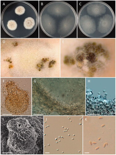 Figure 6. Morphology of Paracamarosporium noviaquum. (A) Colonies on PDA; (B) Colonies on MEA; (C) Colonies on OA; (D, E) Conidiomata on PDA; (F) Pycnidium; (G, H) Conidiogenous cells on pycnidial wall; (I) Ostiole of pycnidium; (J) 1-celled conidia; (K) 2-celled conidia; (D, E) Observed using stereo-microscope; (F–H, J, K) LM; (I) SEM) (scale bars: F = 100 μm; G, H = 20 μm, I = 40 μm; J, K = 10 μm).