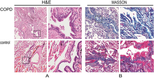 Figure 1 Staining of airway tissues in control and COPD group.