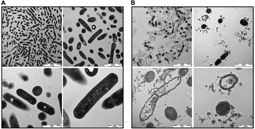 Figure 5. TEM pictures of L. monocytogenes. Bacterial cells were either mock-treated with H2O (a) or treated with 1 mg/ml B2M for 15 min (b) followed by fixation. Ultra-thin sections (80 nm) were imaged in a Zeiss TEM 109 or in a Jeol TEM 1400. Scale bars are 5 µm for upper left, 2 µm for upper right, 1 µm for lower left and 500 nm for lower right pictures