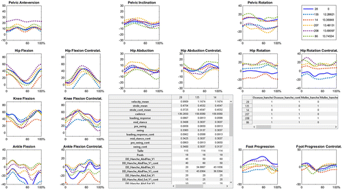 Figure 1. Nearest patients to the tested one. The system gives the bilateral 3D kinematics (in the different subplots), the physical examination parameters and the surgical program (in the two tables) realized on the nearest patients (IDs: 135, 14, 207, 208, 86,...) to the tested one (ID: 28) plotted in plain blue. The clinician may therefore compare the kinematic curves of the studied patient to his nearest counterparts for each joints.