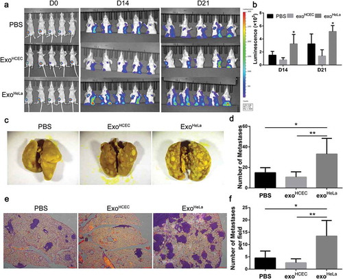 Figure 3. ExoHeLa promoted tumour metastasis in vivo. Luciferase-labelled 4T1 cells were injected into # 4 mammary fat pads of the nude mice. The mice simultaneously were injected with PBS, ExoHCEC, or ExoHeLa as indicated through tail vein (n = 5 for each group). (a) Bioluminescent imaging (BLI) at Day 0, 14 and 21 was examined. (b) Luminescence at Day 14 and 21 in A was quantified. (c) Mice were sacrificed on Day 21. Lungs were harvested and metastases were visualized after fixed with 4% paraformaldehyde containing 10% picric acid. White spots are the metastasized tumours. (d) Quantification of metastasis spots in C. (e). Representative images of lung sections showing tumour metastases in lungs after they were stained with haematoxylin and eosin. Metastasis tumours were stained into purple. (f) Quantification of metastasis spots in E. *P< 0.05, **P< 0.01.