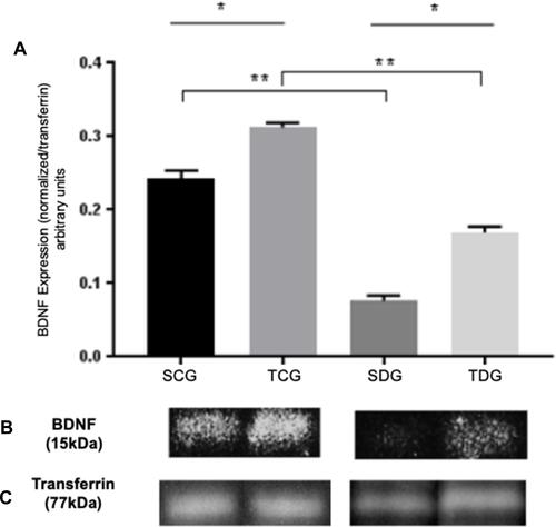 Figure 2 Analysis of BDNF levels of serum samples from trained and sedentary diabetic rats in comparison to controlled healthy groups. (A) Mean (M), standard deviation (SD), and significance of BDNF expression in diabetic and healthy groups, trained and sedentary. Values were obtained from PVDF membrane and expressed as a BDNF/transferrin relation (arbitrary units). * Significant statistical differences (P<0.05) between the same groups are and ** amongst control and diabetes group. (B) Expression of BDNF (15)kDa in sedentary and trained groups, diabetic and healthy. (C) Normalization with transferrin protein stained with Coomassie blue (77kDa).