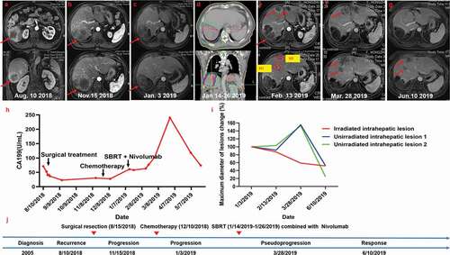 Figure 2. Summary of imaging scans and timeline of therapy and disease status for Case 2