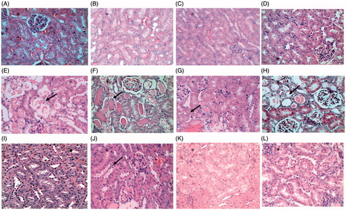 Figure 2. Histopathology of kidney tissue of control and uranyl nitrate treatment groups. Cortical region of kidney: (A and B) (Control), (C and D) (1 d, 2 and 4 mg/kg) – intact tubular epithelium no damage, E (3 d, 2 mg/kg) – tubular damage, loss of microvilli, F (3 d,4 mg/kg) – extensive necrosis and cast formation in tubules, G (5 d, 2 mg/kg) – necrosis of proximal tubular epithelium, H (5 d, 4 mg/kg) – extensive necrosis of proximal tubular epithelium, I (14 d, 2 mg/kg) – tubular regeneration, J (14 d, 4 mg/kg) – basophilic regenerating epithelium lines most of the proximal tubules, K (28 d, 2 mg/kg) – intact tubular epithelium, L (28 d,4 mg/kg) – advanced regeneration of tubular epithelium.
