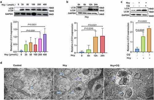 Figure 3. Homocysteine promotes the activation of autophagy in mouse granulosa cells. (a) Protein expression levels of light chain 3-II in mouse granulosa cells treated with different concentrations of homocysteine (0, 25, 50, 100, and 200 µmol/L) for 24 h, as determined by western blot analysis. (b) Protein expression level of light chain 3-II in mouse granulosa cells treated with 200 µmol/L homocysteine for 0, 6, 12, and 24 h, as determined by western blot analysis. (c) Protein expression level of light chain 3-II in mouse granulosa cells treated with 200 µmol/L homocysteine and/or 100 µmol/L chloroquine, as determined by western blot analysis. (d) Representative images of autophagosomes in mouse granulosa cells treated with 200 µmol/L homocysteine and/or 100 µmol/L chloroquine, as detected by transmission electron microscopy. Scale bar = 200 nm. Data are presented as mean ± SD, and experiments were repeated at least three times.