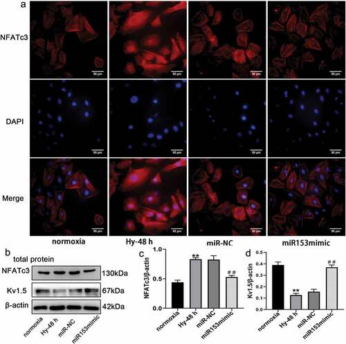 Figure 8. Over expression of miRNA153 reverses the hypoxia-reduced expression of Kv1.5 in PASMCs. (a) Immunofluorescence images showing translocation of NFATc3(red) into DAPI-stained nuclei (blue) in PASMCs (400× magnification). (b, c, d) Immunoblot analysis of NFATc3 and Kv1.5 from PASMCs treated with miR153mimic. *P < .05, **P < .01 vs normoxia group; #P < .05, ##P < .01 vs miR-NC group. The results are expressed as the mean ± SEM. miRNA153, microRNA153; Kv1.5, potassium voltage-gated channel subfamily A member 5; PASMCs, pulmonary arterial smooth muscle cells; NFATc3, nuclear factor of activated T cell isoform c3; SEM, standard error of mean.