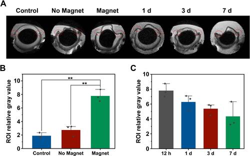 Figure 11 High-resolution of MRI tracking in vivo. (A). Representative images of eyes by MRI. Left-right: Control (no injection), No Magnet; 12 hour after receiving PSC NP-labeled miPSC-TM, Magnet; 12 hours, 1, 3, and 7 days after receiving PSC NP-labeled miPSC-TM cells. The grayscale values in the red circles are analyzed using ImageJ. (B). Quantification analysis of the grayscale values in the TM regions. The magnet facilitates the accumulation of PSC NP-labeled miPSC-TM cells at the TM. **P < 0.01 by one-way ANOVA. (C). Quantification analysis of the grayscale values in the TM region after receiving cells for 1, 3, 7 days. No significant difference is observed. Data shown represent means ± SD.