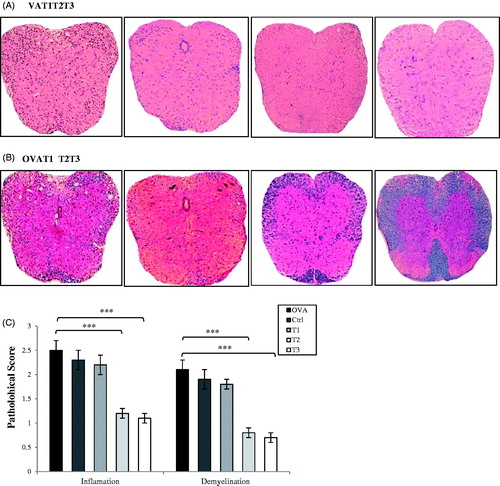 Figure 2. Comparative histopathology of spinal cords demonstrated that high and medium level of estrogen suppresses CNS inflammation and demyelination. Histopathological evaluation of spinal cords from all groups was performed. All ovariectomized treatment groups were implanted with 3 different 21-day release 17β-estradiol pellets and OVA group with placebo pellets. Spinal cords from each group, collected on day 21 post-immunization, were fixed in paraformaldehyde and embedded in paraffin. Five micrometer sections from different regions of the spinal cord from each of the groups were stained (A) with H&E to enumerate infiltrating leukocytes and (B) with Luxol fast blue to assess demyelination. (C) CNS inflammatory foci and infiltrating inflammatory cells were quantified. Pathological scores including inflammation and demyelination were analyzed and shown with bar graph as mean scores of pathological inflammation or demyelination ± SEM. Data are representative of 3 independent experiments. *p < .05, **p < .01, and ***p < .001, T1, T2, T3 and Ctrl groups compared with OVA group. Mice were divided into five groups: 1. Control group (Ctrl), 2. Ovariectomized group (Ova), 3. Low dose estrogen treatment group (T1), 4. Medium dose estrogen treatment group (T2),and 5. High dose estrogen Treatment group (T3).