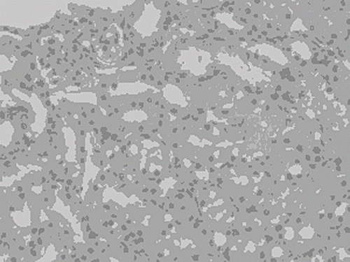 Figure 1. Light microscopic examination of focal areas of granulovacuolar degeneration of proximal tubule epithelium in AK group (HE × 200).