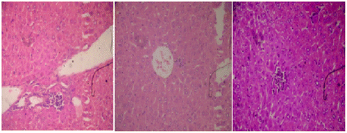 Figure 2a. Cyclophosphamide (150 mg/kg)-treated group, a section of mouse liver showing portal inflammation, hepatocellular necrosis, and lymphocytic inflammatory infiltrations (Hematoxylin and eosin-stained paraffin section; H&E 200).