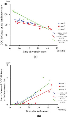 Figure 5. The time course of the GCC thickness and the area of abnormal GCC thickness on the hemianopic side in patients with homonymous hemianopia (Cases 1–3).