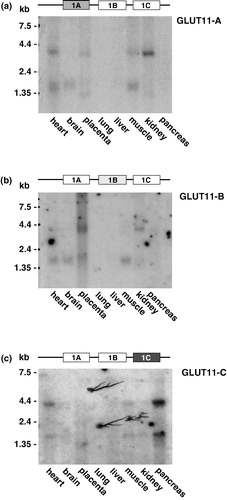 Figure 2. Northern blot analysis of the tissue distribution of GLUT11-A, -B, and -C. Northern blots with mRNA from the indicated human tissues were hybridized with (a) a GLUT11 cDNA probe specific for exon 1A (50811–51032 bp; genomic clone AP000350), (b) a GLUT11 cDNA probe specific for exon 1B (51340–51574 bp), and (c) a GLUT11 cDNA probe specific for exon 1C (51914–52073 bp).