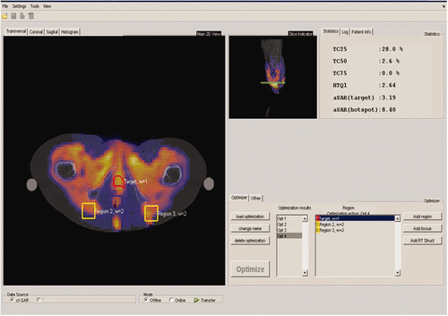 Figure 4. Layout of the VEDO software, used for monitoring, optimization and visualization of the treatment.