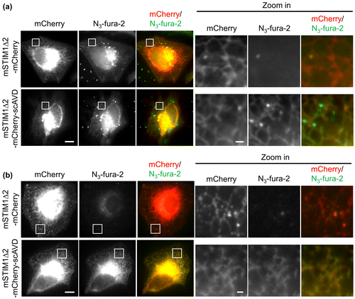 Figure 3. Fluorescence images showing colocalization of N3-fura-2 with ER in live (a) and fixed (b) scAVD-overexpressing HeLa cells. Regions in squares are zoomed in and shown in right panels. Scale bars, 10 μm for left panels, and 1 μm for right panels.