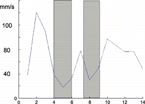 Figure 1. The velocity of the distel point (5 cm away from the osteum) of RCA. Shaded area represents the phase of relatively slow velocity. (View this art in color at www.dekker.com.)