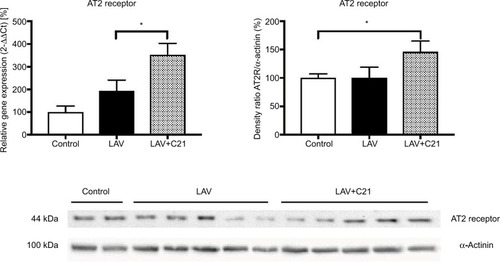 Figure 6 Relative mRNA and protein expression of the AT2 receptor in the lung of rats with mechanical ventilation (control; n=9), repeated pulmonary lavage and mechanical ventilation (LAV; n=9), and repeated pulmonary lavage, mechanical ventilation, and direct stimulation of the AT2 receptor with C21 (0.03 mg/kg body weight; LAV+C21; n=9).Notes: Lungs were extracted after 240 min of mechanical ventilation and real-time polymerase chain reaction (left) or immunoblotting (right) was performed. GAPDH served as housekeeping gene and α-actinin served as loading control. Expression of control was set to 100%. Data are presented as mean±SEM, Mann–Whitney U-test, *p<0.05 compared with LAV group (n=9).Abbreviations: AT2, angiotensin II type 2; C21, Compound 21; GAPDH, glyceraldehyde-3-phosphate dehydrogenase; SEM, standard error of the mean.