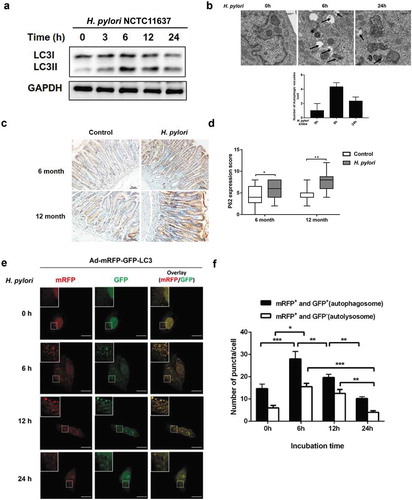 Figure 2. Autophagy is dynamically changed in response to H. pylori infection. (a) Representative images of Western blot analysis for LC3 in GES-1 cells co-cultured with H. pylori NCTC11637. (b) Transmission electron microscopy showing autophagosomes in gastric cells with or without H. pylori infection. Scale bar: 500 μm. (c) The Mongolian gerbils were challenged with H. pylori NCTC11637 strain or Brucella broth 6 months (H. pylori, n = 30; control, n = 15) or 12 months (H. pylori, n = 30; control, n = 10). Representative p62 immunohistochemical staining images in gastric tissues were shown. Scale bar: 50 μm. (d) Quantification of staining scores for p62 in gastric epithelium. (e) After transfection with mRFP-GFP-LC3 adenovirus, cells were incubated with H. pylori and Confocal microscopy was used to monitor the autophagic flux. Scale bar, 10 μm. (f) The numbers of autophagosome (mRFP+GFP+) and autolysosome (mRFP+GFP−) were quantified. All in vitro experiments were independently repeated three or more times. *P < .05, **P < .01, ***P < .001.