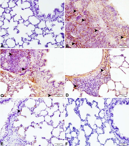 Figure 4. Expressions of TNF-α in lung tissues of septic rats (magnification 40×). (A) Lung tissue of the control group with negative TNF-α protein expression (IHC-P, bar = 50 µm). (B) Lung tissue of the CLP group with very severe TNF-α protein expression (arrowheads) (IHC-P, bar = 50 µm). (C) Lung tissue of the SBR1 group with severe TNF-α protein expression (arrowheads) (IHC-P, bar = 50 µm). (D) Lung tissue of the SBR2 group with moderate TNF-α protein expression (arrowheads) (IHC-P, bar = 50 µm). (E) Lung tissue of the SBR3 group with mild TNF-α protein expression (arrowhead) (IHC-P, bar = 50 µm). (F) Lung tissue of the SBR group with negative TNF-α protein expression (IHC-P, bar = 50 µm).
