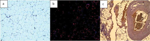 Figure 1. Sample of images used to develop and test AdipoGauge. a) H & E stained mouse adipose tissue image; b) Fluorescently stained macrophages from mouse adipose tissue fixed sections; c) H & E stained human breast tissue section (containing adipose tissue) used for colour separation