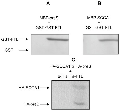 Figure 1 (A) Western blot of preS-pulldowned proteins; (B) Western blot of SCCA1-pulldowned proteins; (C) Western blot of FTL-pulldowned proteins. For A, MBP-preS was pre-incubated with either GST-FTL or GST before mixing with amylose beads; for B, MBP-SCCA1 was pre-incubated with either GST-FTL or GST before mixing with amylose beads; for C, HA-tagged preS and SCCA1 were coexpressed with His-tagged FTL protein in HepG2 cells before immunoprecipitation by anti-His-tag antibody.Abbreviations: MBP, maltose binding protein; GST, glutathione-S-transferase; FTL, ferritin light chain; SCCA1, squamous cell carcinoma antigen 1.