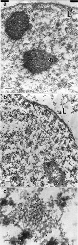 Figure 2. The RNP network of the nucleus is well preserved after chromatin removal. Shown are epon sections of CaSki cervical carcinoma cells before (a) and after (b) the isolation of a crosslink stabilized nuclear matrix and selectively stained for RNA by the EDTA- regressive procedure [Citation76] to visualize the RNP-network. The nuclear lamina (L) forms the periphery of the nucleus (panel A) and is retained in the nuclear matrix (panel B). The removal of chromatin after formaldehyde crosslinking does not substantially alter the structure or spatial distribution of the nuclear RNP network. (c) Higher magnification reveals well-preserved interchromatin granule clusters, enriched in RNA-splicing factors, in the RNP-network of the crosslink-stabilized nuclear matrix. The CaSki nuclear matrix in this panel was counterstained with an antibody recognizing the RNA-splicing factor SRm160 and a colloidal-gold-conjugated second antibody. The bar in panels a and B is 500 nm and in panel C the bar is 200 nm. This is from Figure 4 of Nickerson et al. [Citation82].