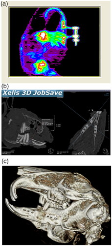 Figure 4. (A) DEXA. (B,C) Three-dimensional (CT) images showed healthly distracted bone and unilateral crossbite.