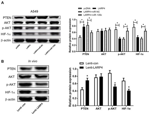 Figure 6 Effects of circLARP4 or along with miR-135b on the PTEN/AKT/HIF-1α signaling pathway in NSCLC. (A) The protein levels of PTEN, p-AKT, AKT and HIF-1α in A549 cells transfected with LARP4, pcDNA, LARP4 + miR-135b or LARP4 + miR-NC were detected by Western blot analysis. (B) Western blot analysis of PTEN, p-AKT, AKT and HIF-1α protein levels in xenograft tumor tissues. *P < 0.05.