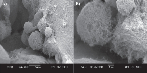 Figure 3 SEM imaging of a cluster of neural stem cells cultured in a RADA16-I-BMHP1 self-assembled scaffold. Low- (A) and high-magnification (B) images highlight cell bodies partially but tightly wrapped with functionalized nanofibers.