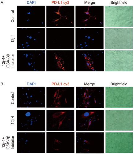 Figure 6. Representative immunofluorescence images of PD-L1 (red) and nucleic (blue) foci in MDA-MB-231 cells treated with or without 12j-4 (4 μM) combined with GSK-3β inhibitor (40 nM) for 48 h. (A) PD-L1 protein expressed in organelle membranes with cell membrane ruptured; (B) PD-L1 protein expressed in organelle membranes with cell membrane non-ruptured.