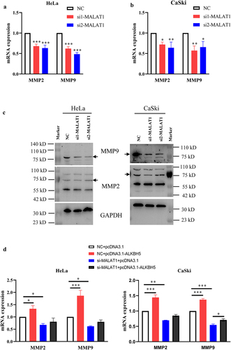 Figure 6. Effect of the MALAT1-ALKBH5 axis on MMP2 and MMP9 expression.