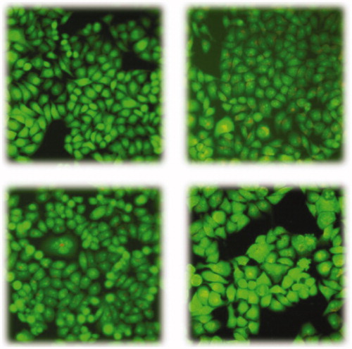 Figure 3. Morphologic changes of A549 cells under inverted microscopy and fluorescence microscopy. 3(a) the control group cell treated with nothing; 3(b) Experimental group treated with 1.33 μM concentration of afatinib. 3(c) Experimental group treated with 1.59 μM concentration of 14. 3(d) Experimental group treated with 0.41 μM concentration of 44.