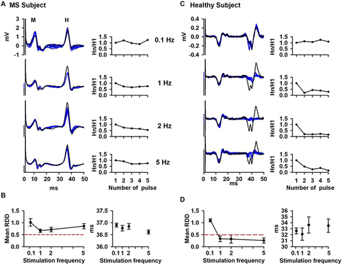 Figure 3 Loss of RDD of the H reflex in the MS patient. (A) MS subject. Left panel, superimposed traces of the H reflex evoked at 0.1, 1, 2, and 5 Hz. Black traces represent the first pulse while the blue ones represent the following pulses (2–4). Right panel, corresponding graphs of the RDD expressed as Hn/H1. (B) Mean RDD (left panel) and latency of the H reflex (right panel). (C) Corresponding traces and graphs as shown for the MS subject are presented in a healthy subject for comparison. (D) Mean RDD (left panel) and latency of the H reflex (right panel) in the healthy subject. Red dotted lines in B and D point out 0.5 as a reference value for comparative purposes.